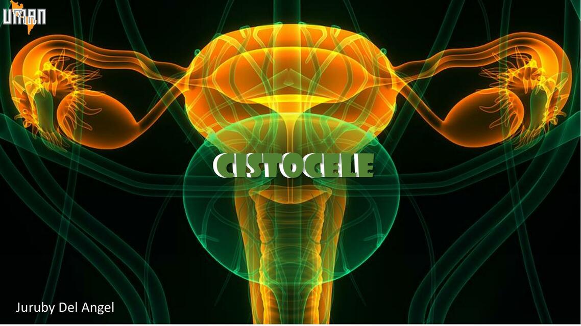 Cistocele