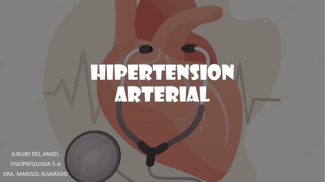 Hipertensión Arterial 