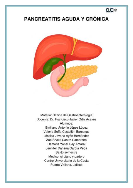 Pancreatitis Aguda y Crónica 