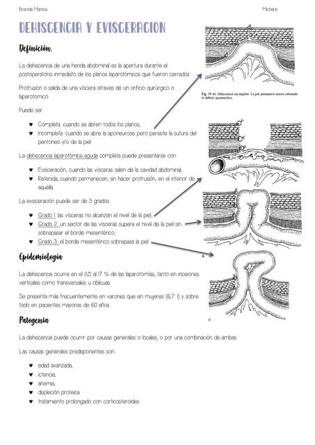 Dehiscencia y Evisceración 