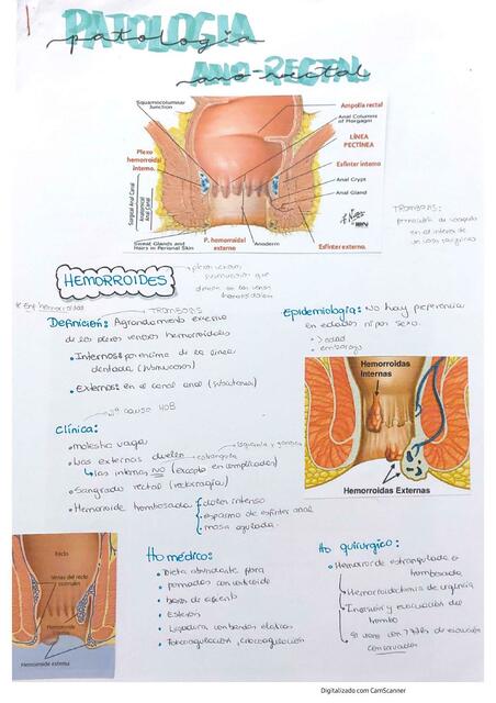 Patología Ano- Rectal