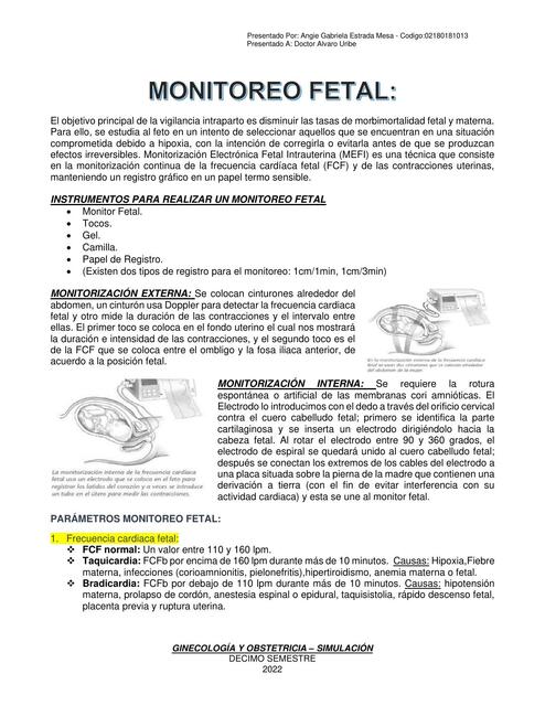 Monitoreo Fetal 