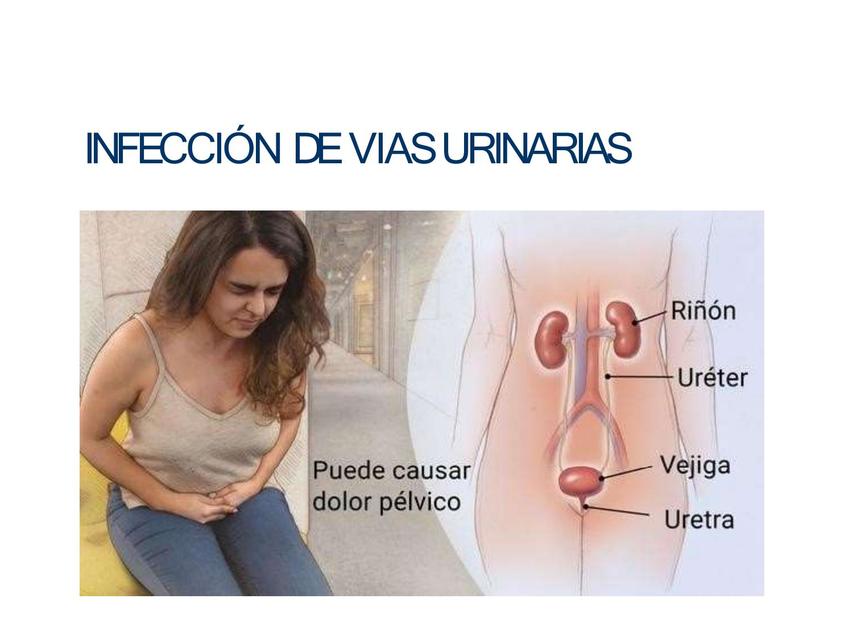 Infección de vías urinarias 