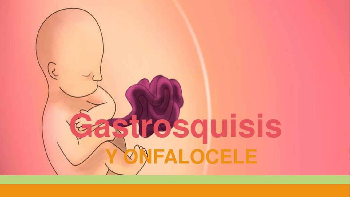 gastrosquisis y onfalocele