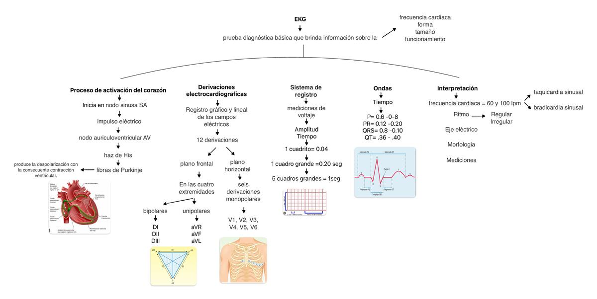 EKG