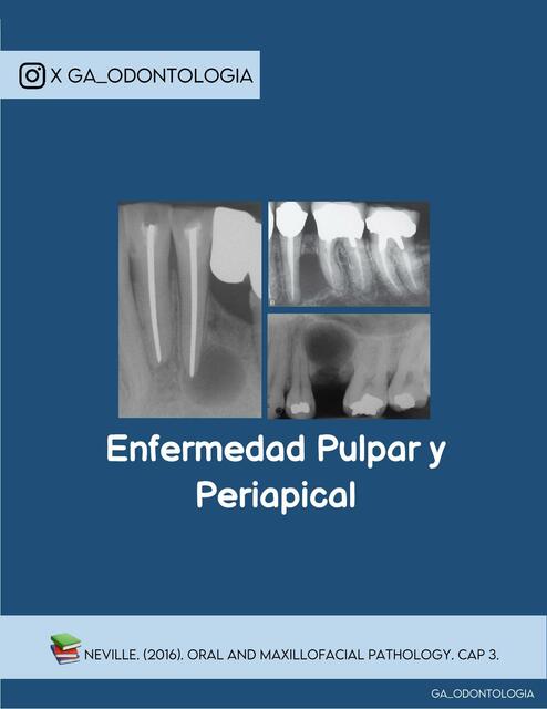 Enfermedad pulpar y periapical