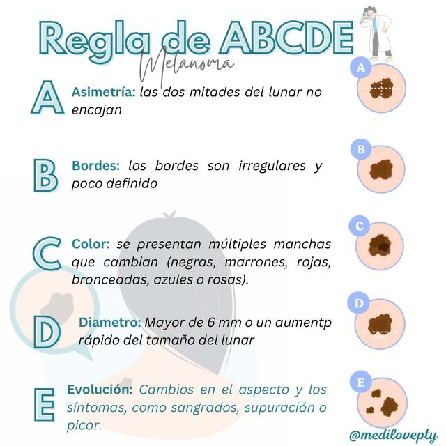 Regla de ABCDE