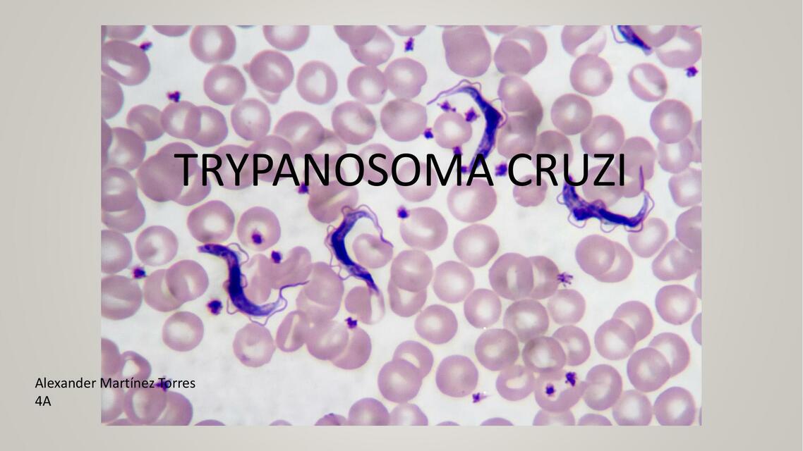 Trypanosoma Cruzi 