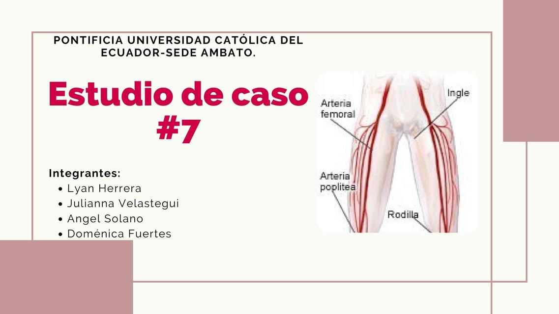 Estudio de caso 7  