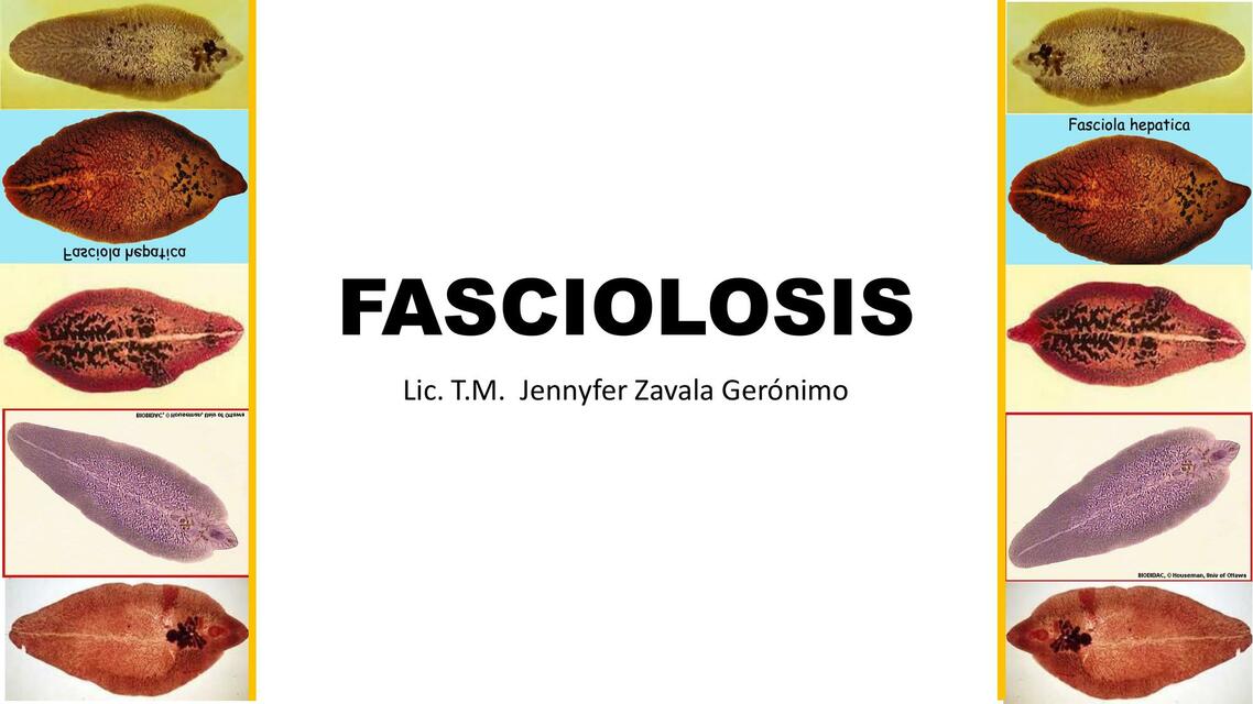 Fasciolosis