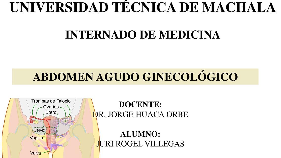 Abdomen agudo ginecológico 