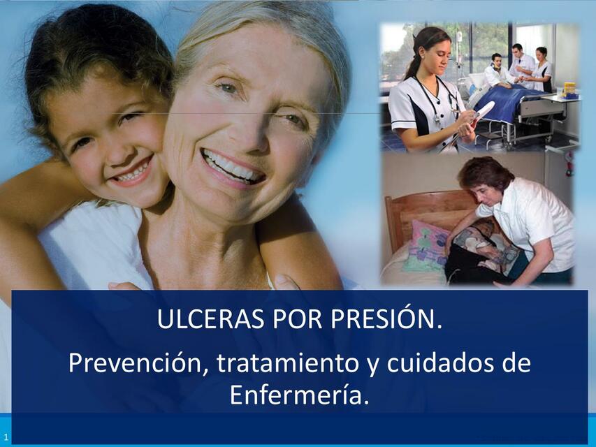Úlceras por presión: Prevención, tratamiento y cuidados de enfermería