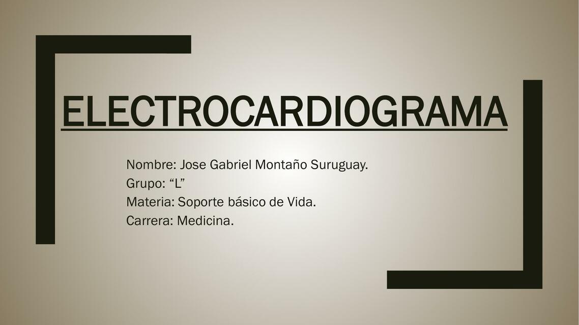 Electrocardiograma