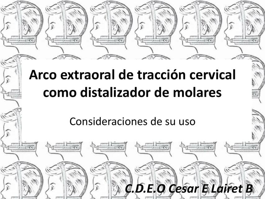 Arco extraoral de tracción cervical como distalizador de molares. Consideraciones de su uso