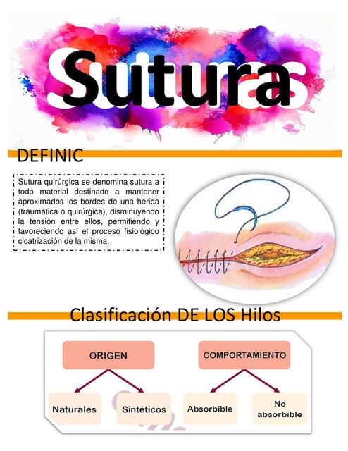 Suturas 