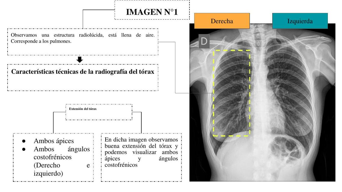 Resolución De RX- Primer Caso | MiddleMedic | uDocz