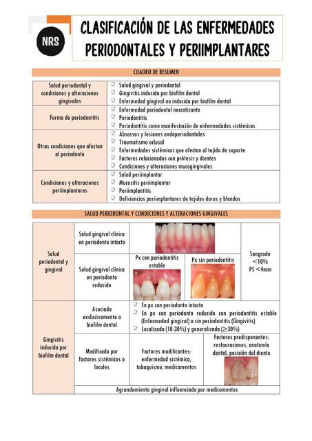 Clasificación de las Enfermedades Periodontales 