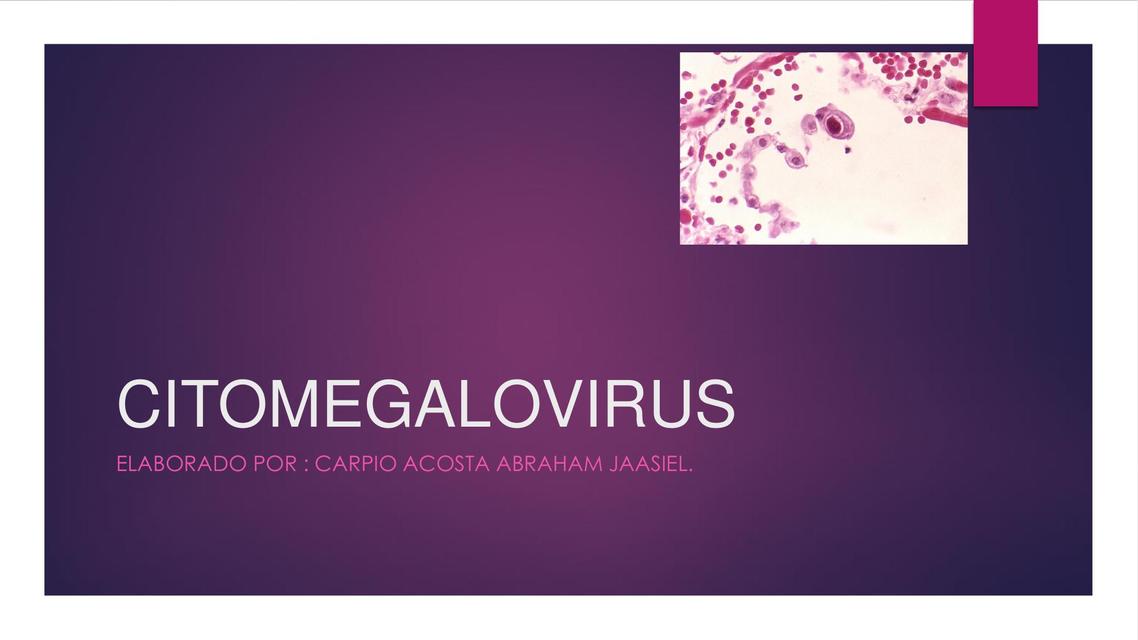 Citomegalovirus  