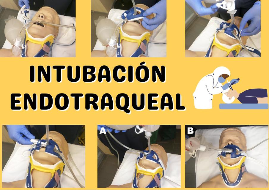 Intubación Endotraqueal 