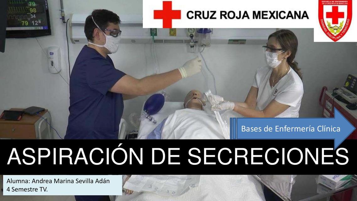 Aspiración de Secreciones  