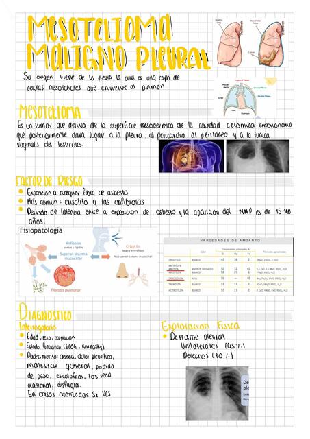 Mesotelioma maligno pleural