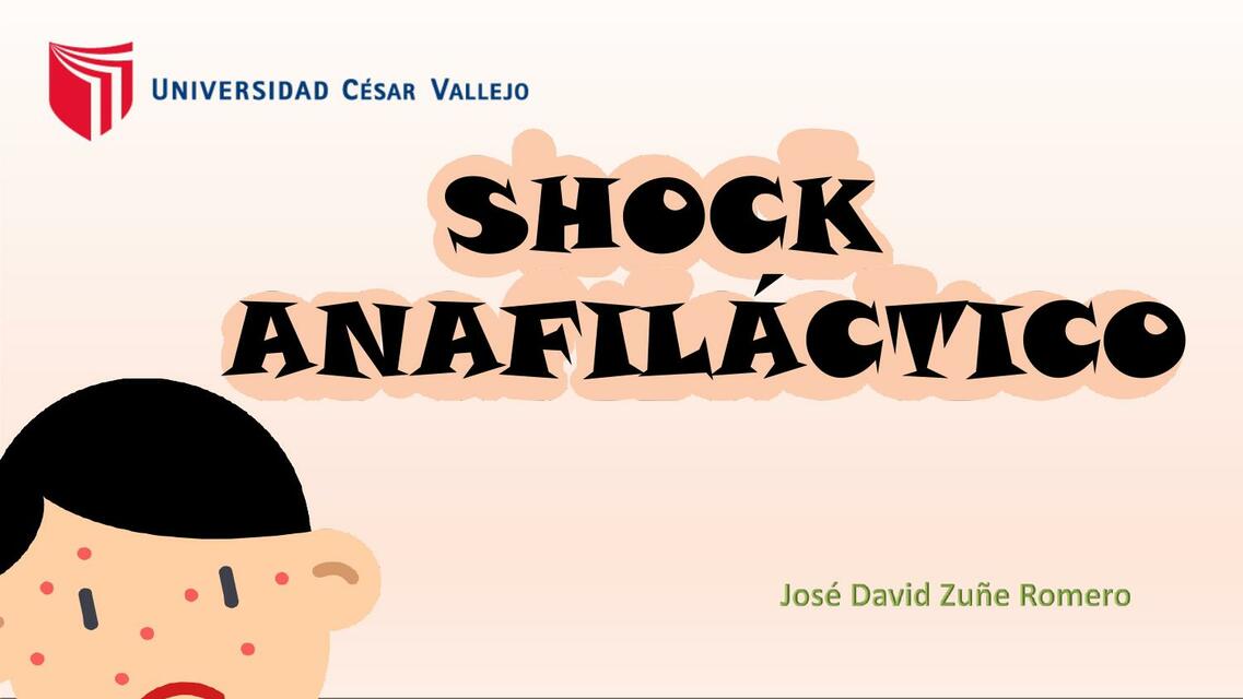 Shock anafiláctico pediatría