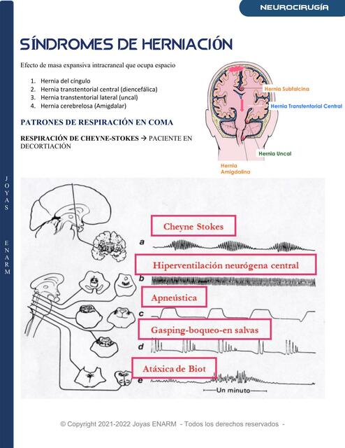 Síndromes de Herniación  