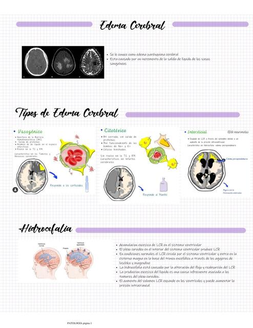 Edema Cerebral