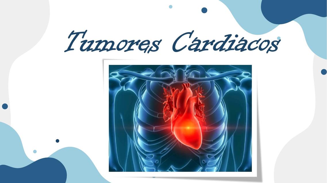 Tumores del corazón