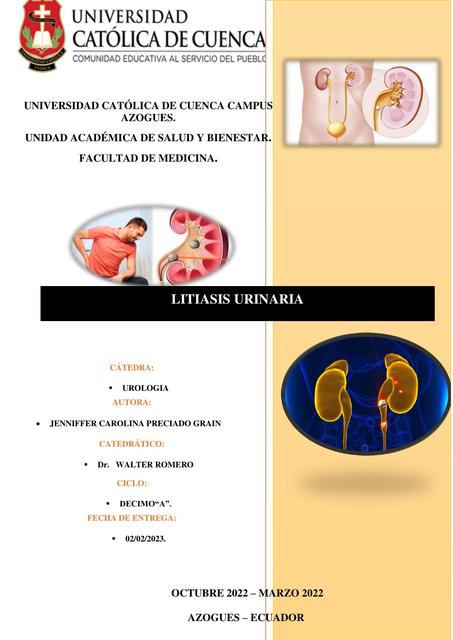 Litiasis Urinaria 