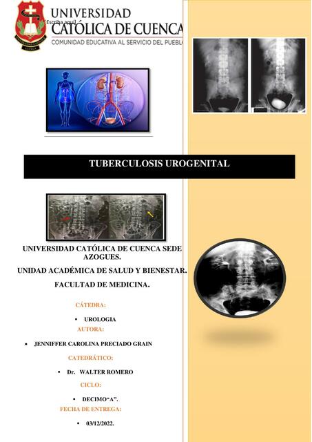 Tuberculosis urogenital 