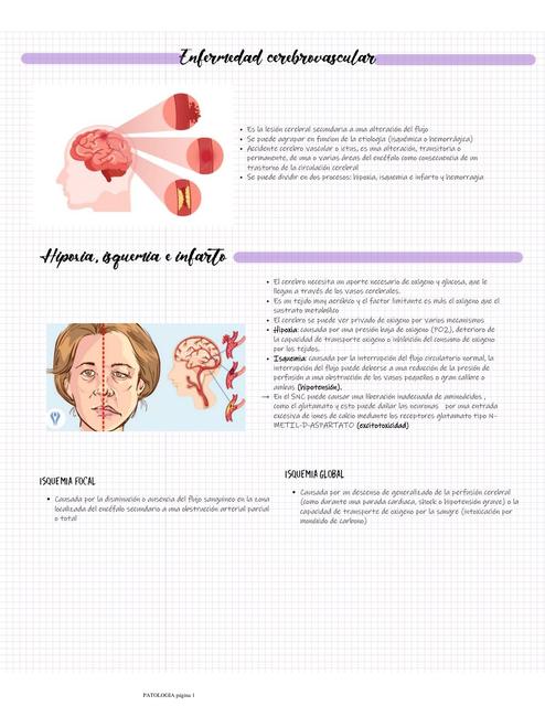 Enfermedad cerebrovascular   