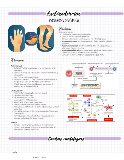 Esclerodermia Esclerosis Sistémica