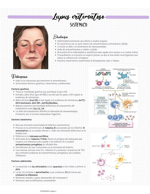 Lupus eritematoso sistémico  