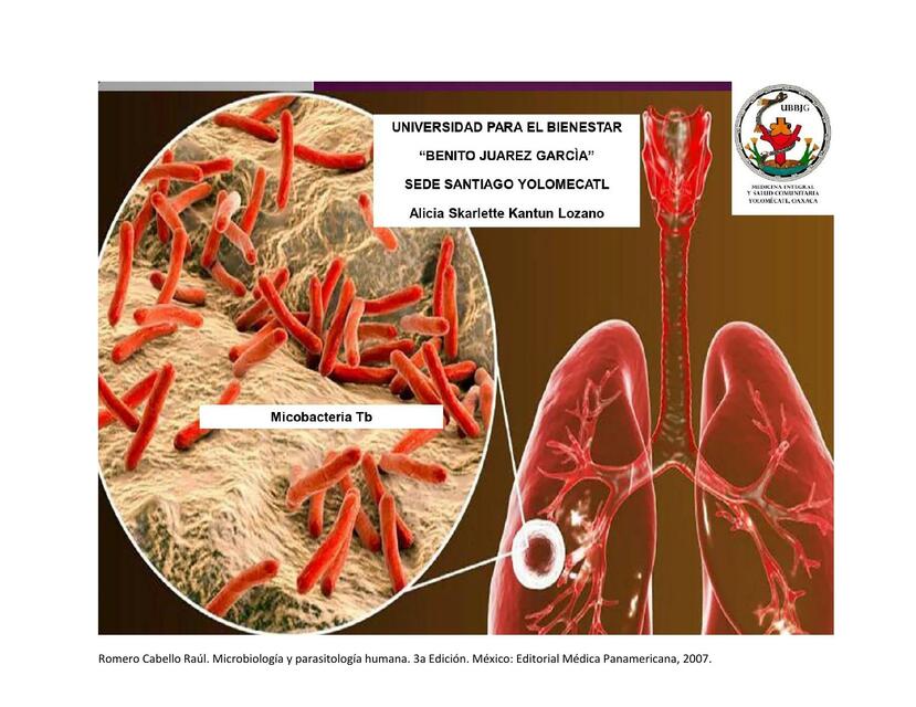 Tuberculosis