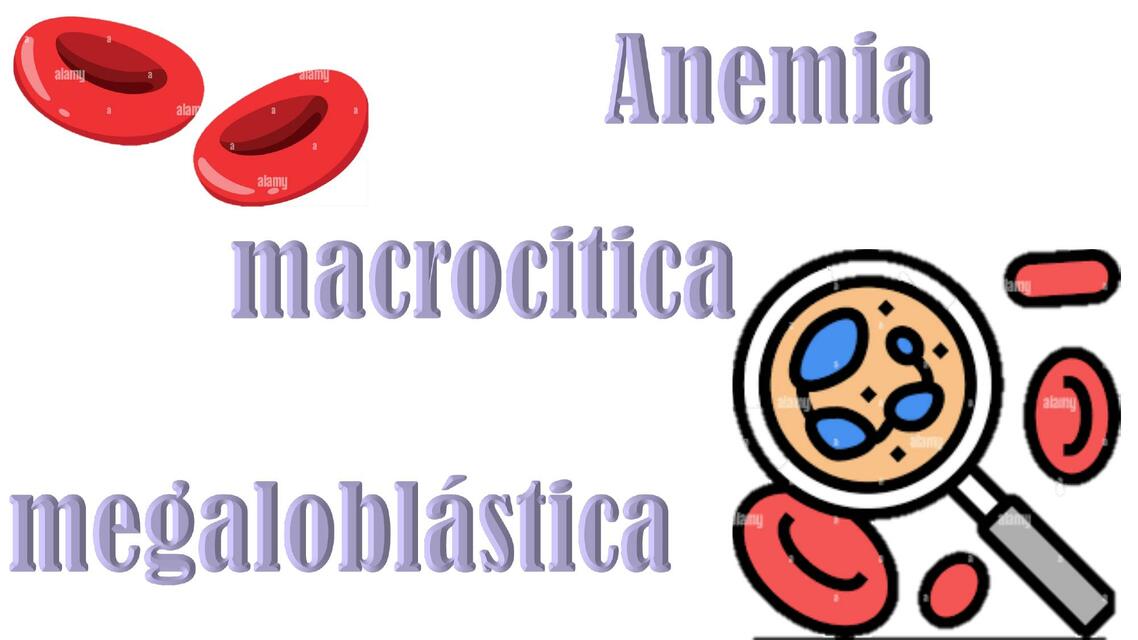 Anemia Macrocítica Megaloblástica