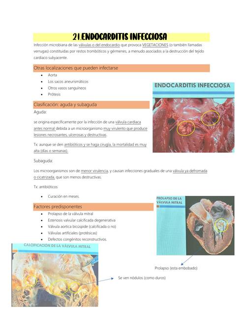 Endocarditis infecciosa 