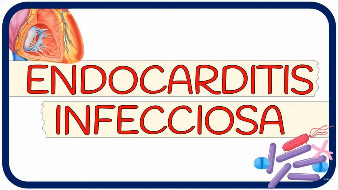 Endocarditis Infecciosa 