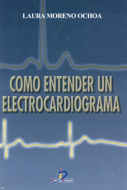 Cómo Entender un Electrocardiograma