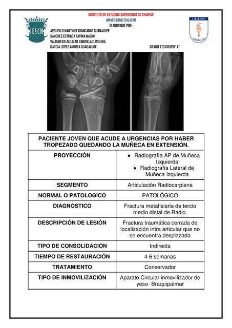 Caso clínico Trauma