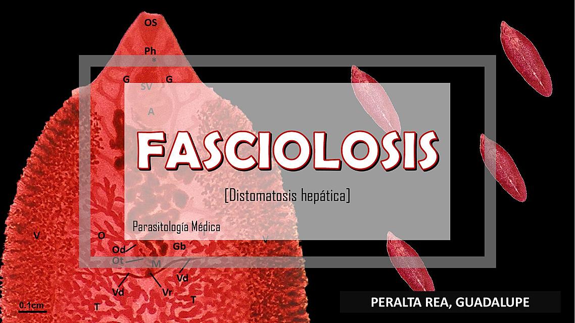 Fasciolosis