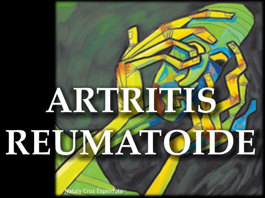 Artritis Reumatoide