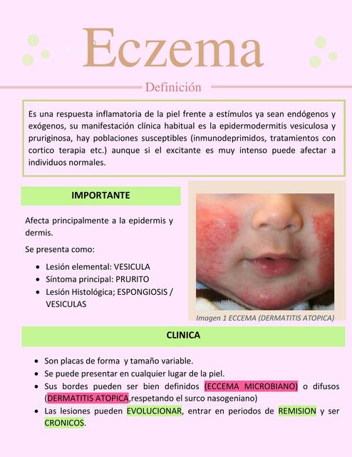 Eczema 