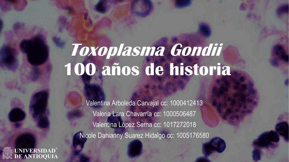 Toxoplasma Gondii