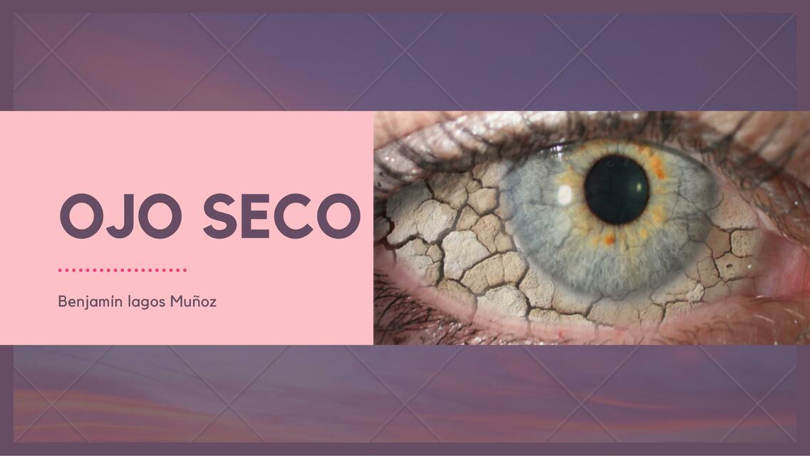 Ojo Seco 