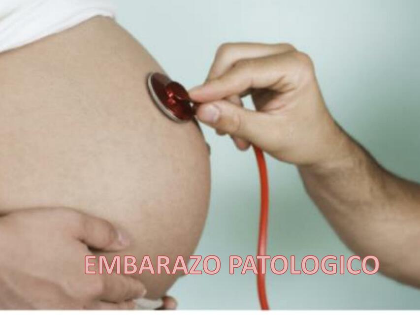 Embarazo Patológico 