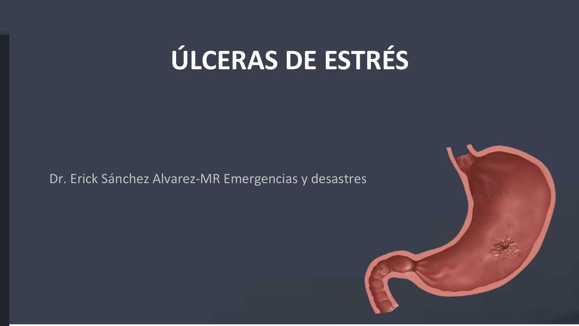 Úlceras por Estrés