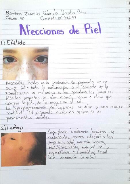 Afecciones de Piel