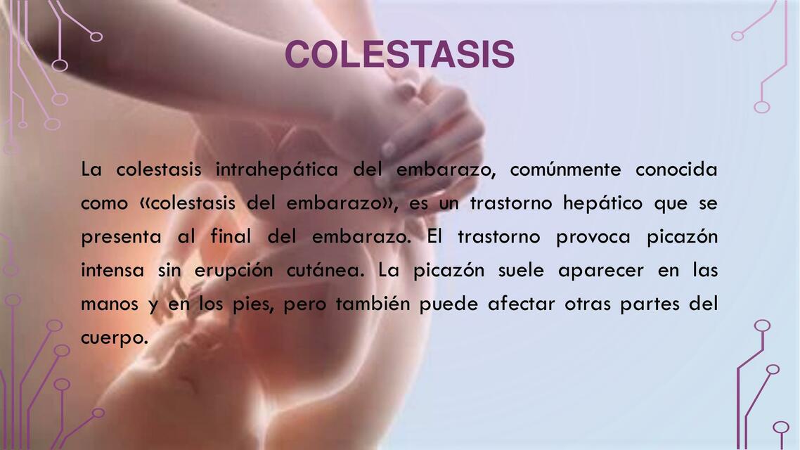 Colestasis 