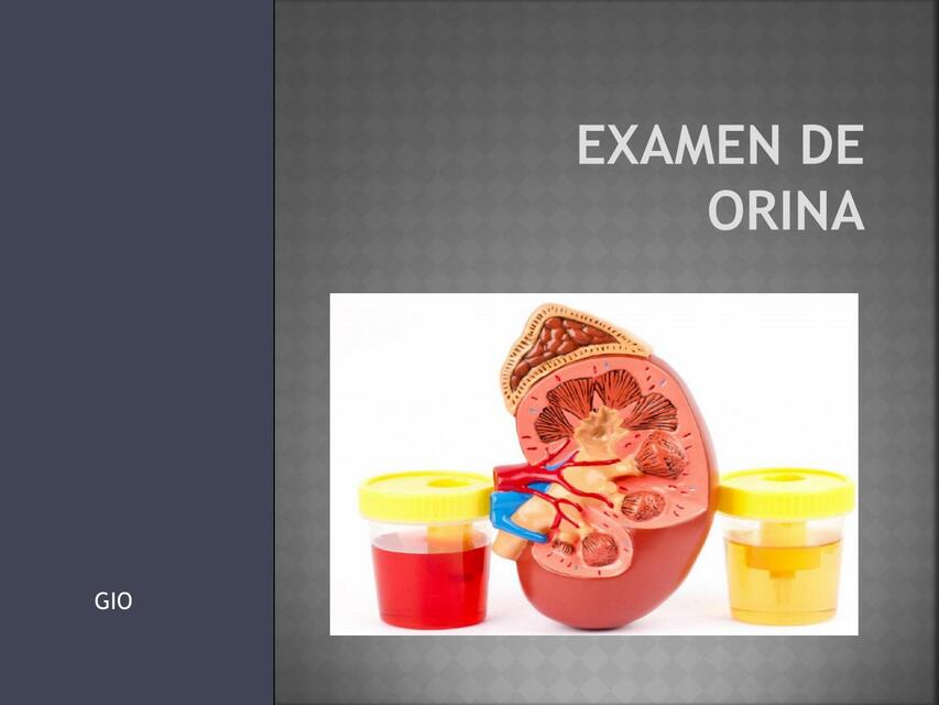 Examen de Orina 